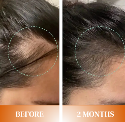 Thyroid Hair Support Vitamins