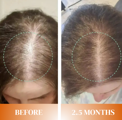 Thyroid Hair Support Vitamins