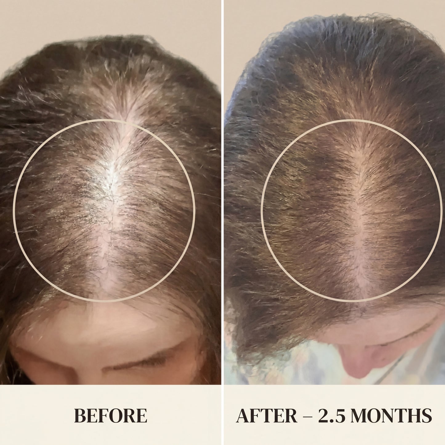 Hair Support Vitamins