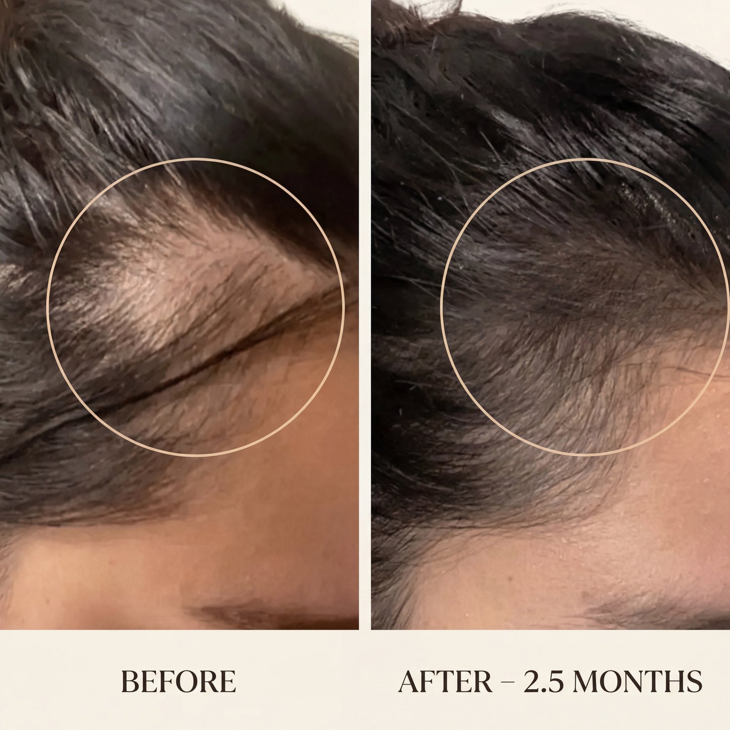 Hair Support Vitamins