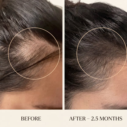 Hair Support Vitamins